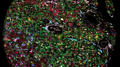 Spatialproteomics: an interoperable toolbox for analyzing highly multiplexed fluorescence image data featured image
